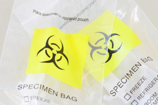Keunggulan Kantong Plastik Infeksius Kuning untuk Pengelolaan Limbah kantong plastik infeksius kuning